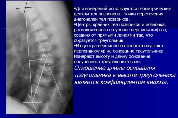 Ссылка в даркнет